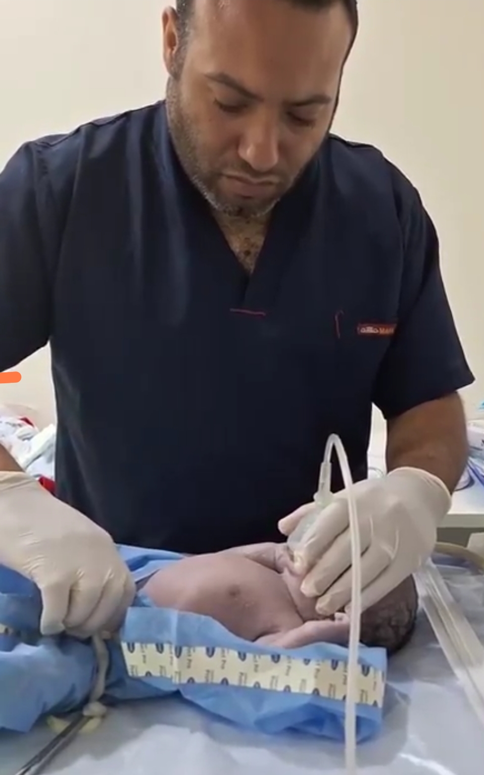 Watch The Amazing Moment Doctor Brought Dead Baby Back To Life (Video)